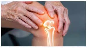 Bone Health - To Not Break a Leg